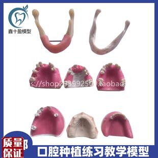 牙科种植模型f缺失牙修复练习切开翻瓣打孔栽钉仿真软牙龈包