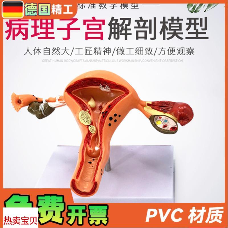 女性大子宫模型放大模型女性z生殖解剖模型计划生育示教模型