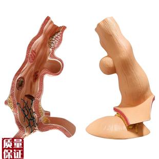 人体食管食道胃部消化系统解剖模型解剖骨骼教学医学.教具厂家包