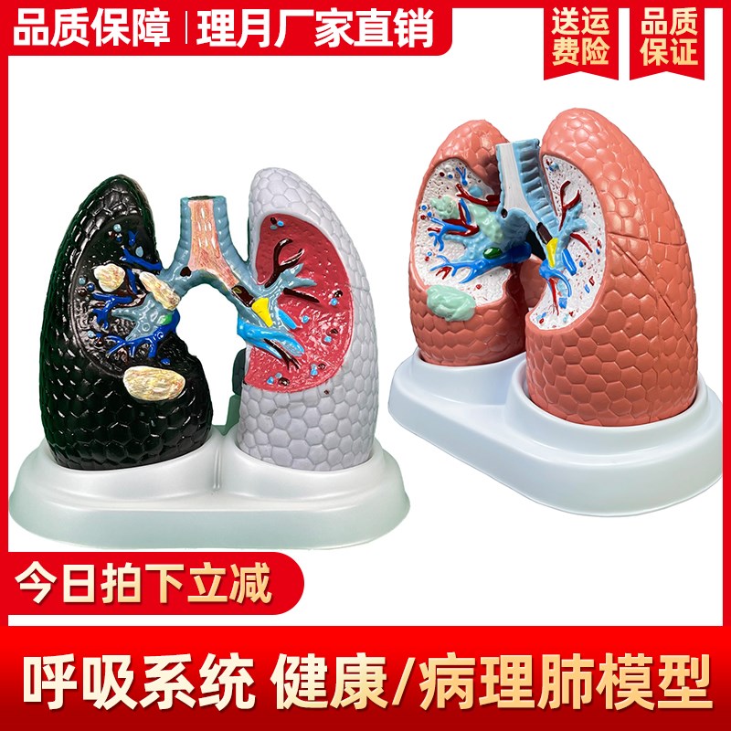 人体肺模型 吸烟癌变肺呼吸科标本健康肺 胸外科R人类内脏肺部解