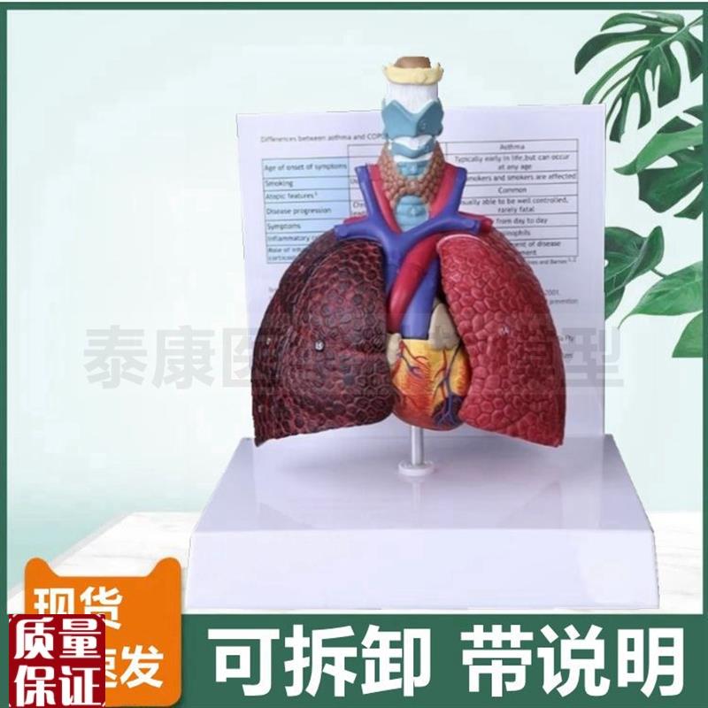 人体呼吸系统模型k喉咙肺支气管可拆卸病理肺医患沟通医药礼品病