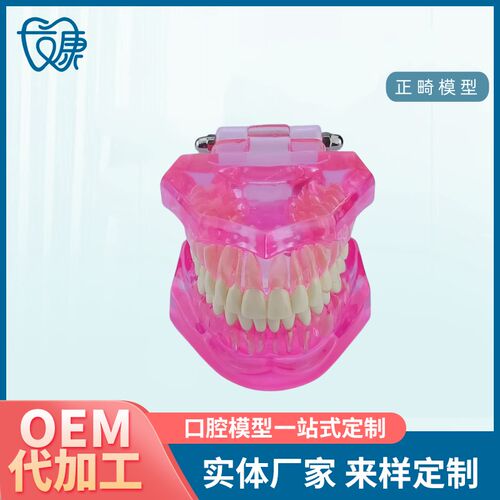 牙齿模型病理修复可拆卸正畸口腔E病理牙模型牙科医患活动沟通