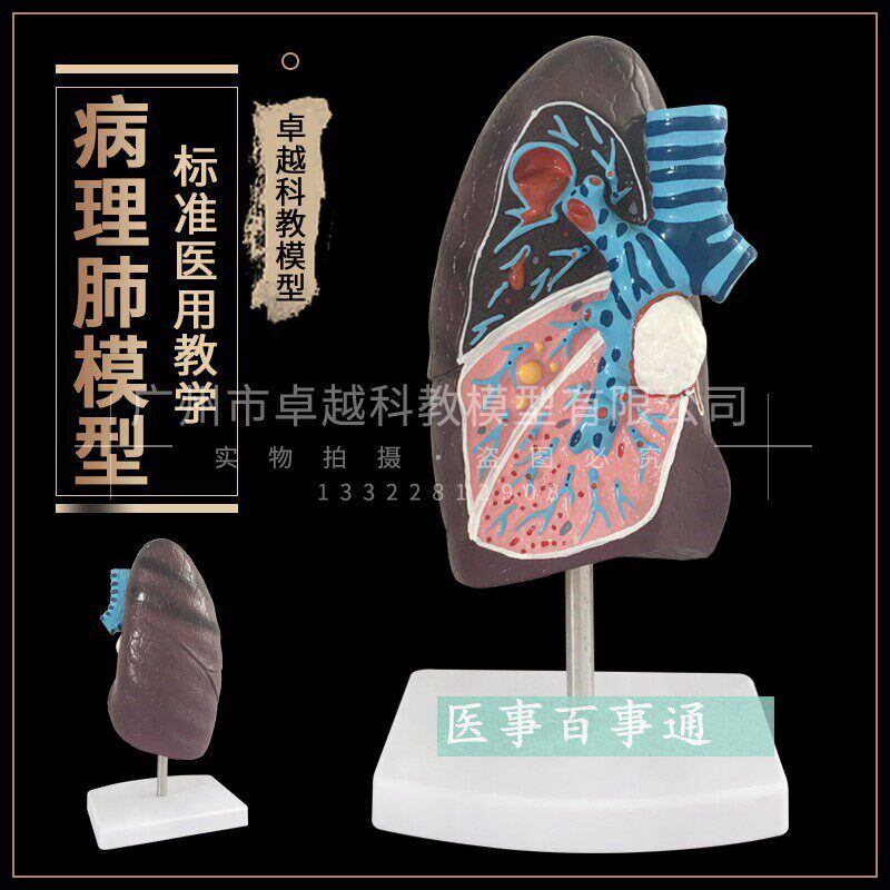 人体肺模型 病理肺解剖模型 呼吸系统G 人体脏器模型 病变肺模型