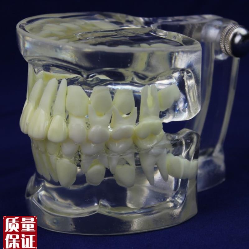ENOVaO颐诺全透明乳恒牙交替模型儿童牙齿列发育指导刷牙模
