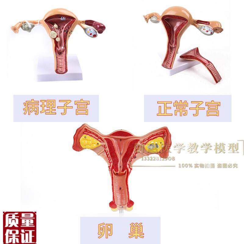 人体子宫卵巢阴道女性内外生殖器官模型生殖科.妇科医用演