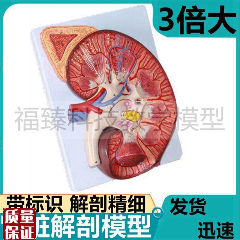 肾脏模型3倍大肾上腺s泌尿内分泌腺体肾结构输尿管蛋白尿肾小