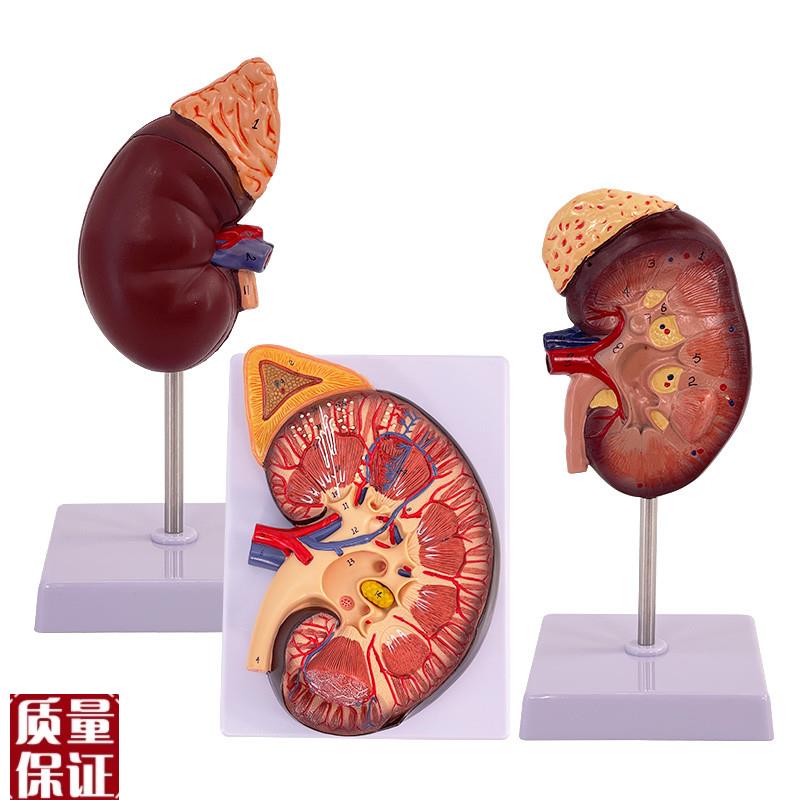 肾脏解剖模型g人体内脏器官模型骨骼自然大肾解剖附肾上腺模