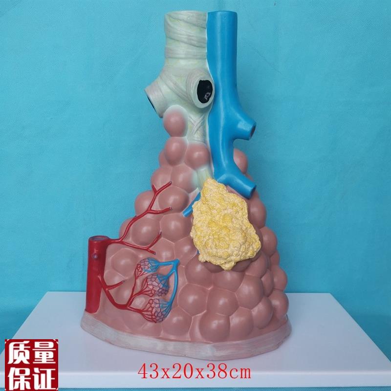 人体病理肺泡放大模型肺解剖内脏医用a教学病理讲解展