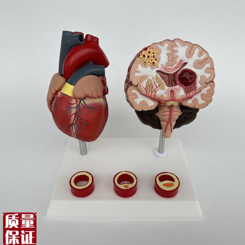 人体心脑血管展示模型血压高心脏模具L与心血管模型对比教具模