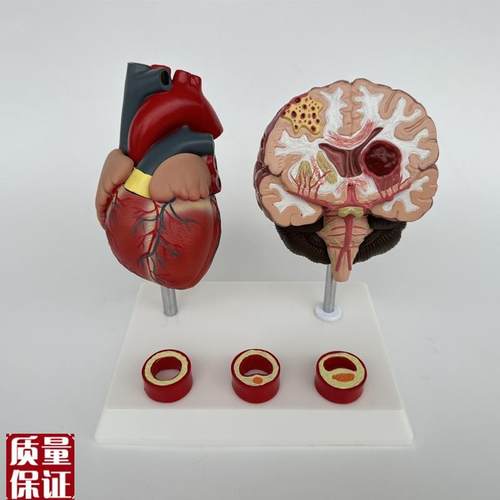 人体心脑血管展示模型血压高心脏模具L与心血管模型对比教具模