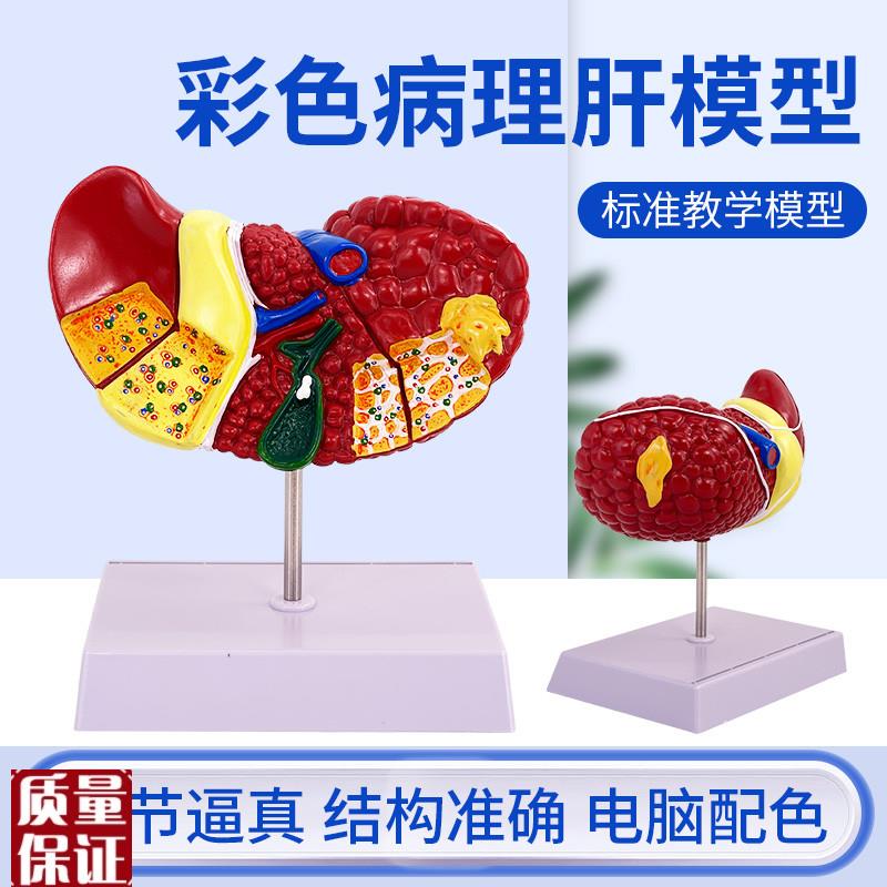 医学仿真人体肝脏解剖模型肝门胆囊胆管结构消S化系统器官演示教