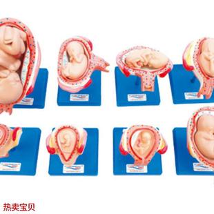 妊娠胚胎发育过程模型42t005胎儿形成发育过程模型双胎子宫模型