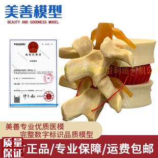 脊柱模型脊椎骨头腰椎间盘模具椎体模型突出受X压病理骨质教