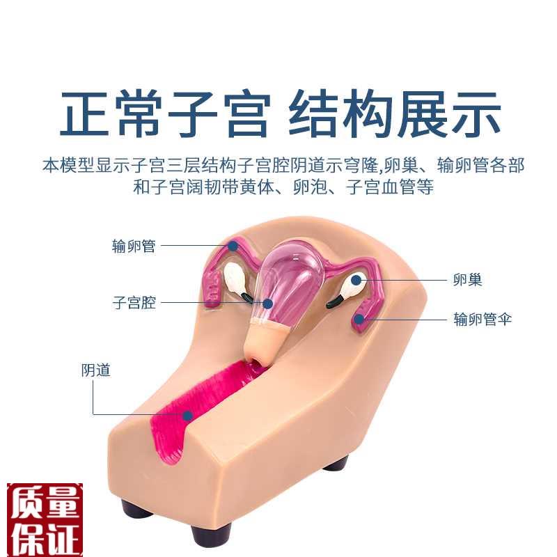女性宫内避孕及训练模型女性节育H计生模型女性宫内避孕模