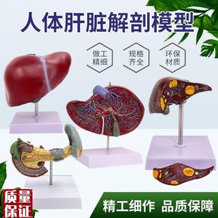 高度仿真肝脏模型肝解q剖肝胆胰脾十二指肠浮雕病变肝胆胰模型教