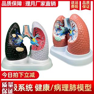 人体肺模型吸烟癌变肺呼吸科标B本健康肺胸外科人类内脏肺部解