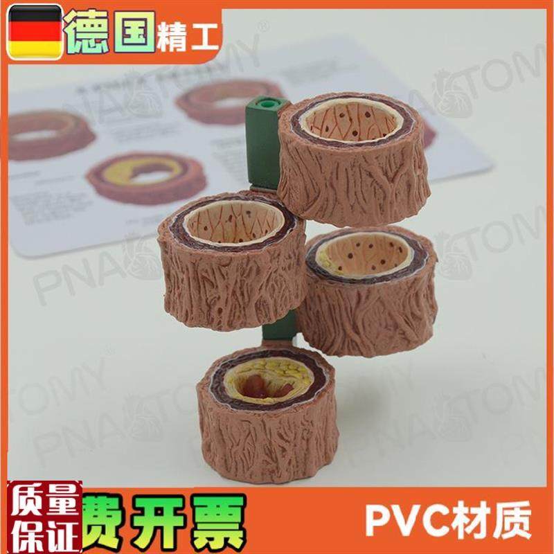 四阶段动脉血管模型粥样化演示教具血管硬化解剖.展示模具礼