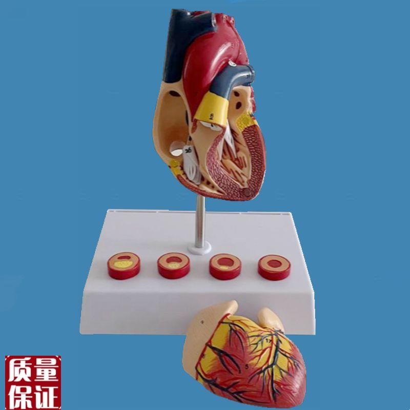 心血管动脉粥样硬化模型冠状动脉病理心室二P尖瓣房间隔主动脉瓣