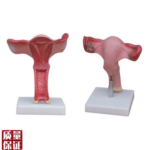 子宫模型b女性子宫放大解剖模型生殖系统生理结构教育卵巢妇产教