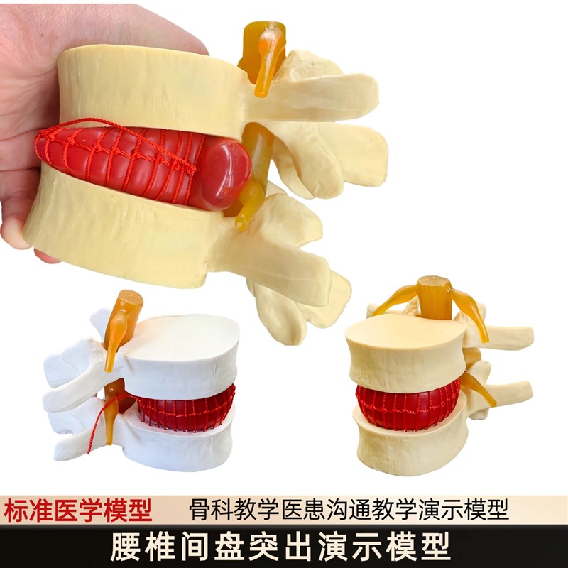 人体脊柱模型脊椎骨头腰椎t间盘模具椎体模型突出受压病理骨质教