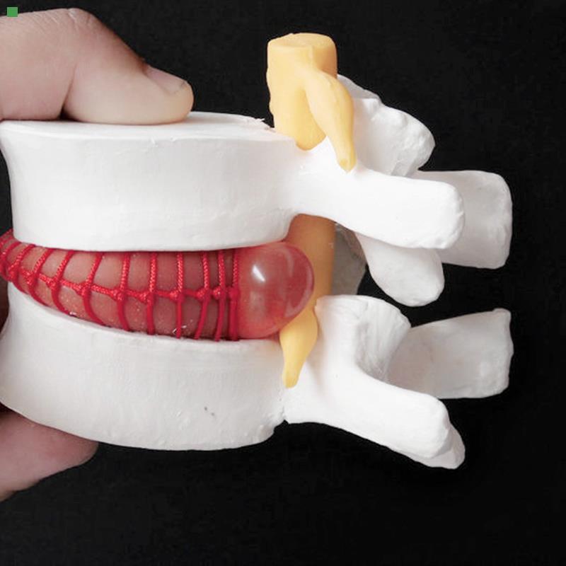 人体腰椎间盘膨出演示模型 腰椎模型 人体脊柱模型脊椎模型