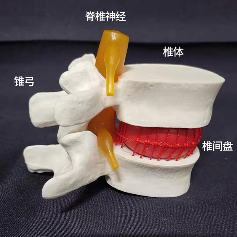 椎间盘模型正f品医学人体腰椎突出脊柱脊椎骨病理演示关节标准模