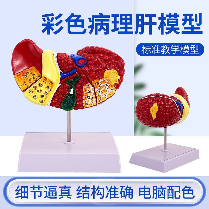 医学仿真人d体肝脏解剖模型肝门胆囊胆管结构消化系统器官演示教