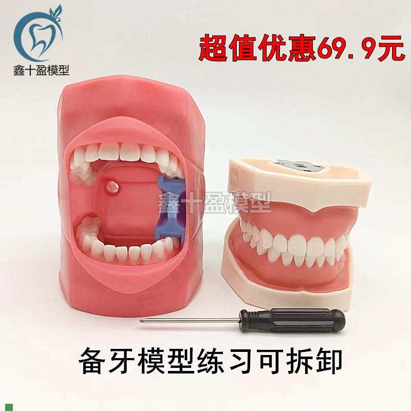 口腔备牙模型仿真牙齿模型练习备C牙粒离体牙口腔考试教学软牙龈