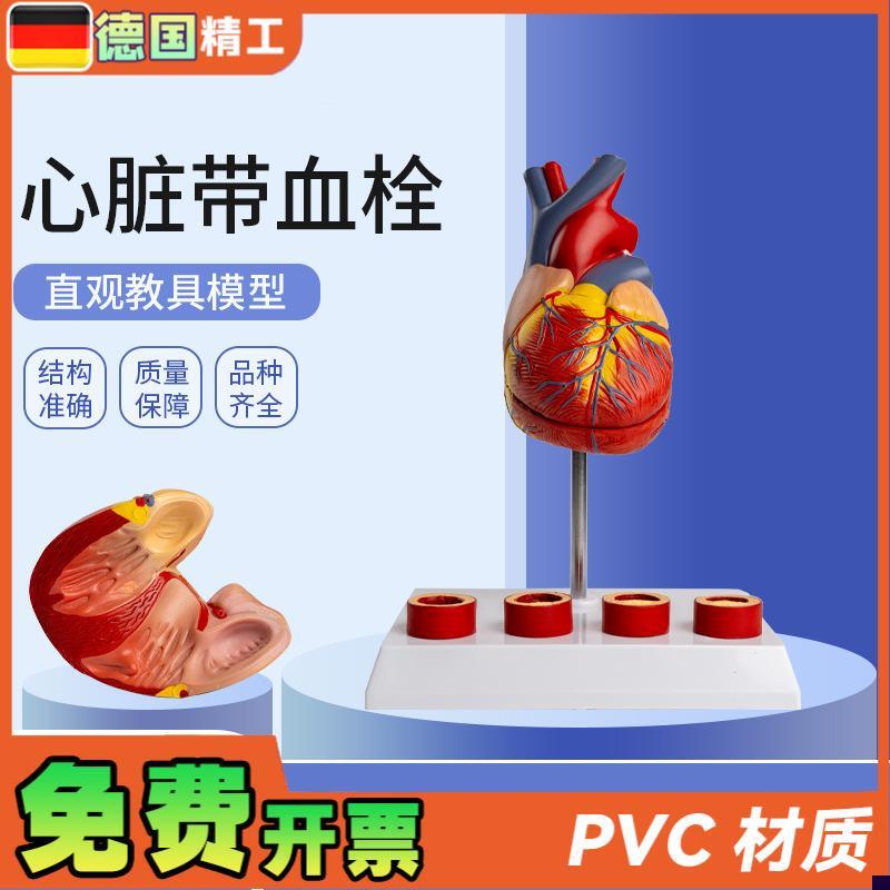 德国】心脏带血栓模型 解剖可拆卸E教学仿真 自然大心脏带血栓血