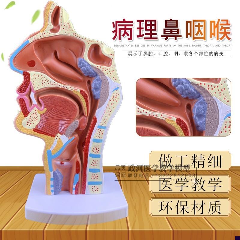 病态鼻咽喉模型医用鼻腔解剖呼吸道模型喉L咙带肌肉血管神经甲状
