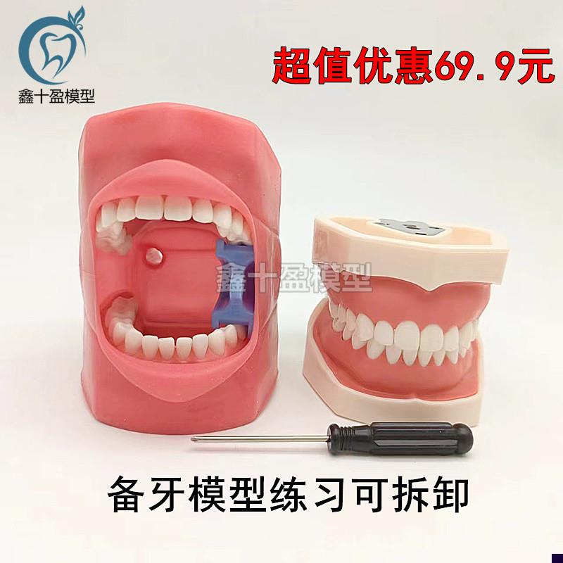 口腔备牙模型仿真牙齿模型练习z备牙粒离体牙口腔考试教学软牙龈