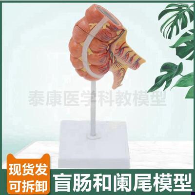 人体阑尾解剖模型 回肠盲肠 w胃肠消化系统 病理结肠 直肠肛周痔