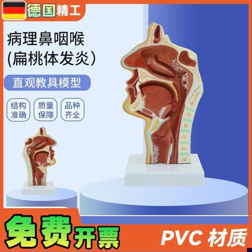 德国】PNT-0736人体鼻腔咽喉C解剖教学模型 病理鼻咽喉(扁桃体发