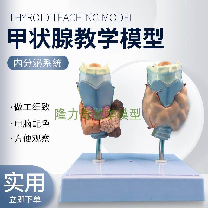 甲状腺病理模型喉头解剖模型甲状I腺瘤甲状腺囊肿甲状腺