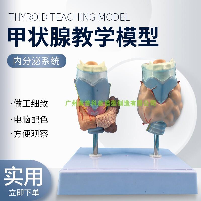 病理甲状腺模型l喉头解剖模型甲状腺留甲状线囊中甲状线