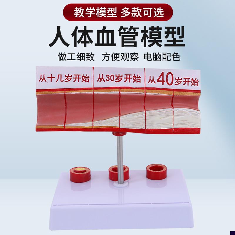 人体血管解剖模型 血管r模型 硬化动脉展示 各阶段年龄层血管演示
