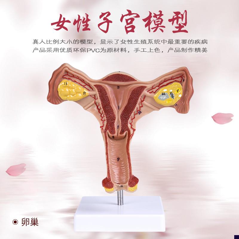 人体子宫解剖模型 女性生v殖系统计生教育演示器材 厂家直销