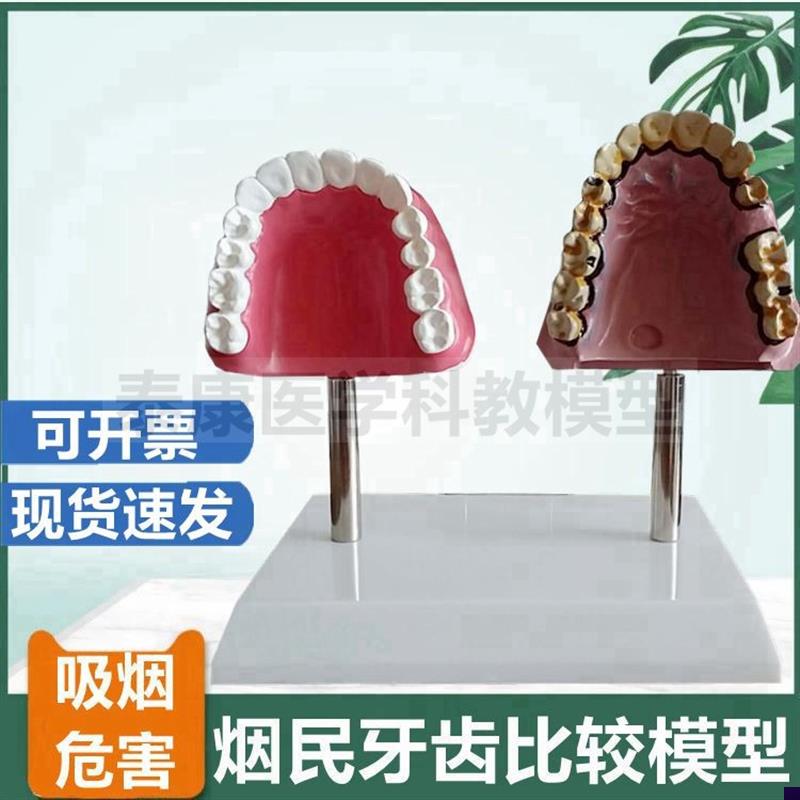 吸烟人的牙齿口腔模n型黄牙戒烟毒教育用吸烟危害人体器官心脏血