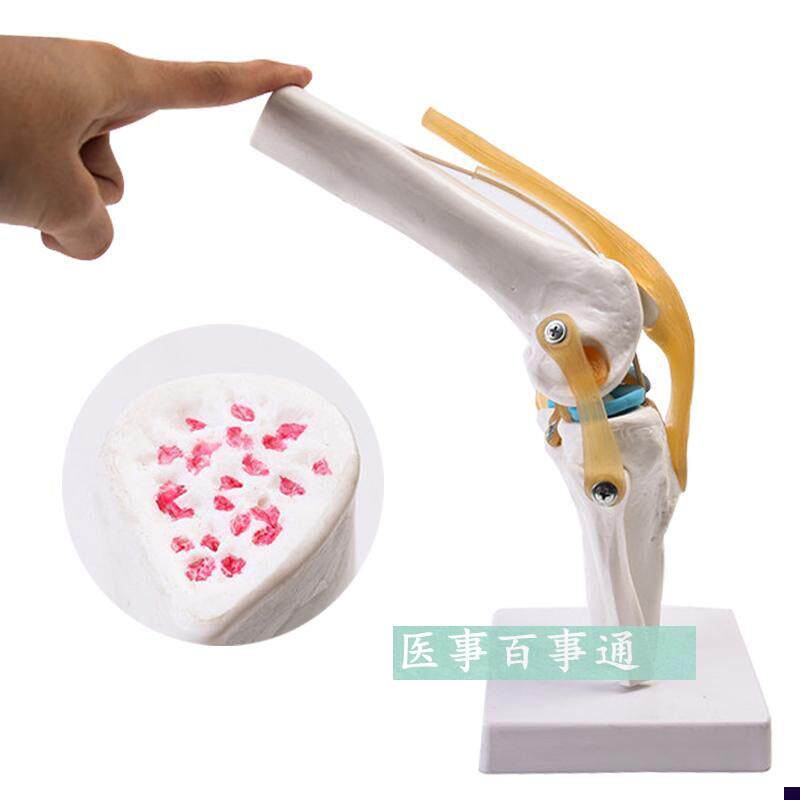 人体功能性膝关节韧带群模型 膝关节H模型 骨科教学展示 膝盖骨