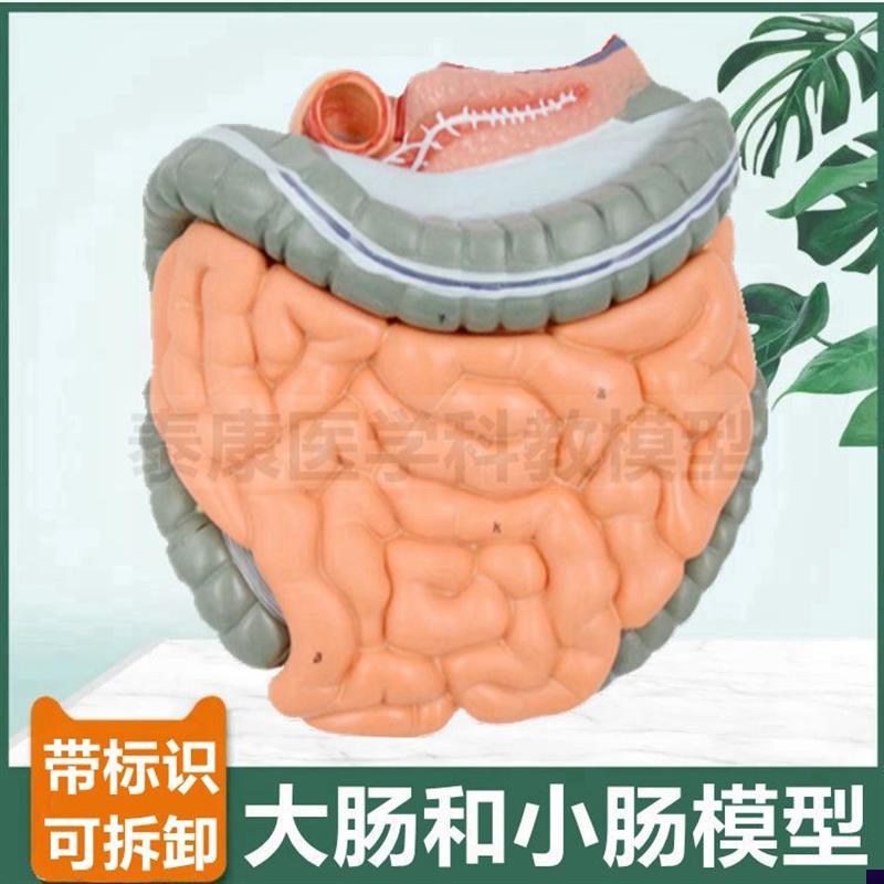 大肠 小肠 肠系膜 肛肠医生用 病理F结肠肛周痔疮盲肠阑尾常见病