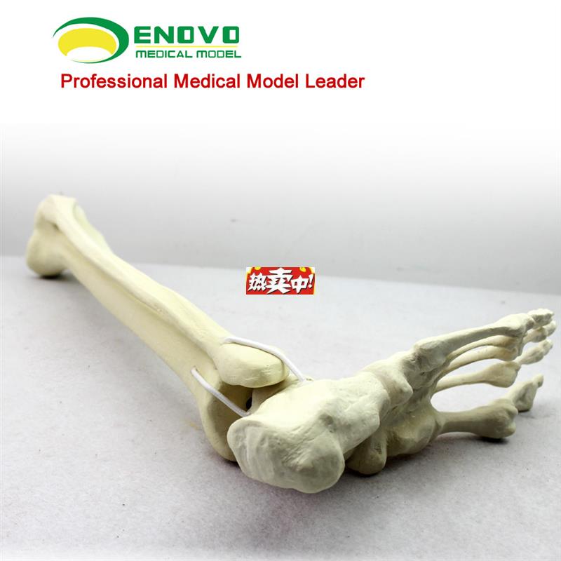 热销骨科手术摸拟SawboneG仿真骨人工合成骨模型足踝模型连接胫腓