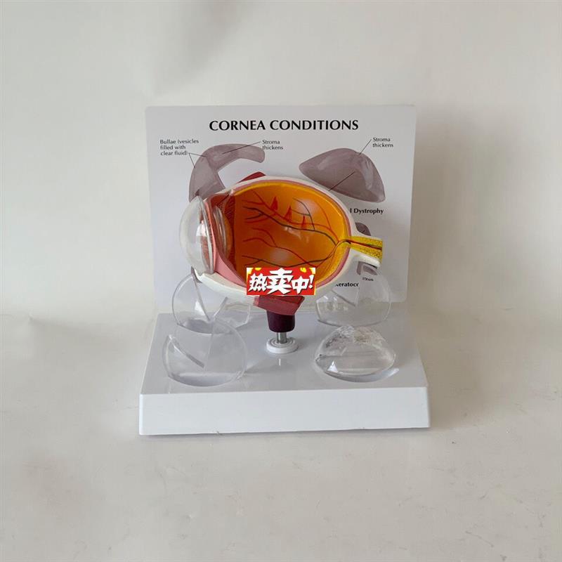 热销角膜模型视力感觉器官白内障青光眼视网膜眼底j眼科教学医患