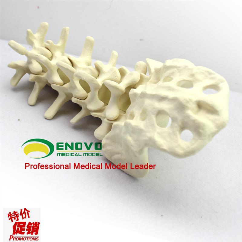 骨科术前Sawbone人体腰椎z模型人工骨模型骨科手术仿真骨演示
