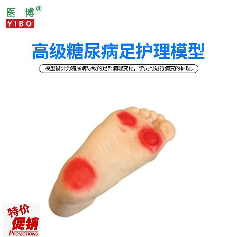 医博BIX-HS19糖尿病足护理模型H足部病理展示示教模型教具