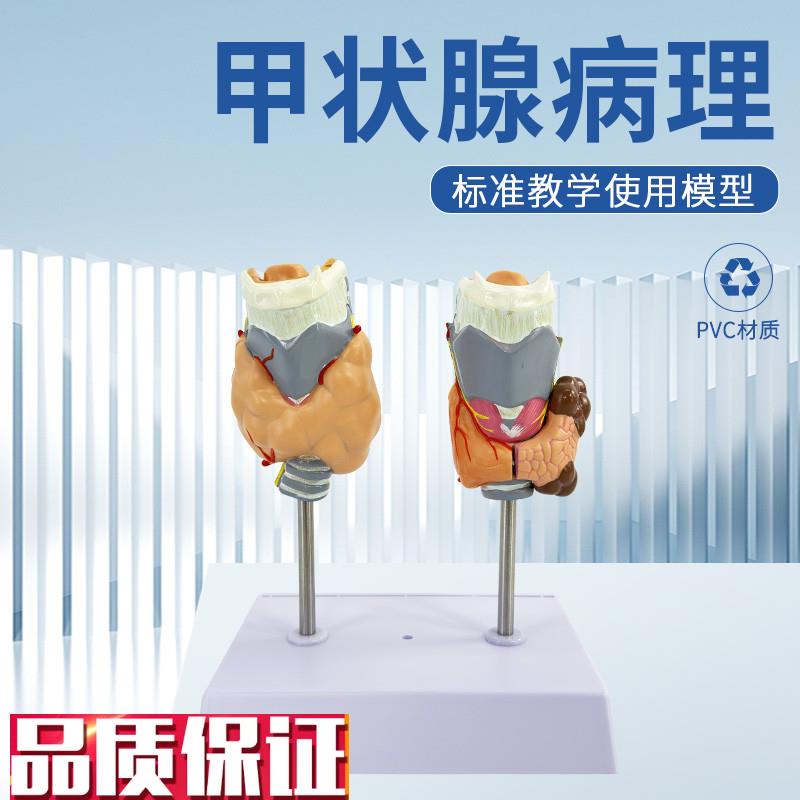 人体病理甲状腺模型甲亢甲低内分D泌系统医学解剖甲状腺喉头教具