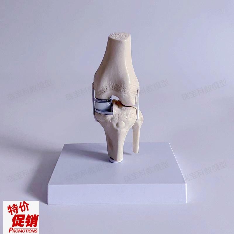 膝关节单髁置换人工膝盖半月板软骨假体J替换临床骨科手术演示操