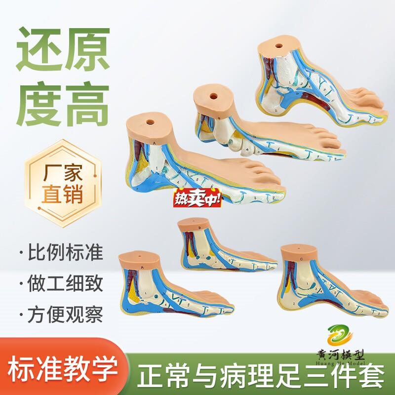 热销脚模型正常足扁平足弓型X足解剖模型脚部构结构造肌肉血管教