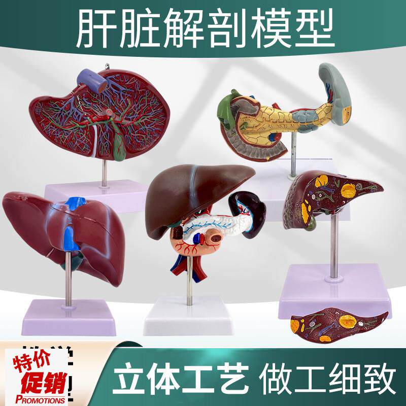 人体肾脏模型肾解剖o附肾上腺放大模型病变肾脏人体内脏器官解剖