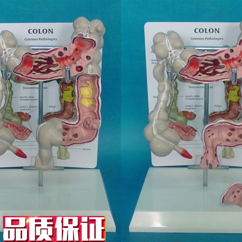 人体十二指肠消化系统解剖模型医用医学教M学教具厂家直销大肠病