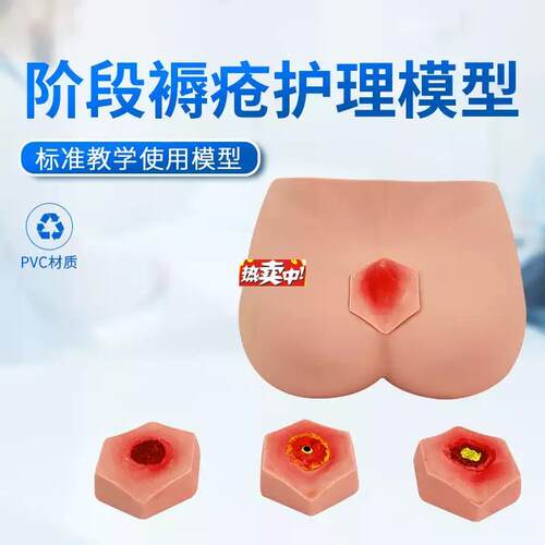 热销阶段褥疮护理模型护理操作不R同阶段四个临床分期成人臀部模